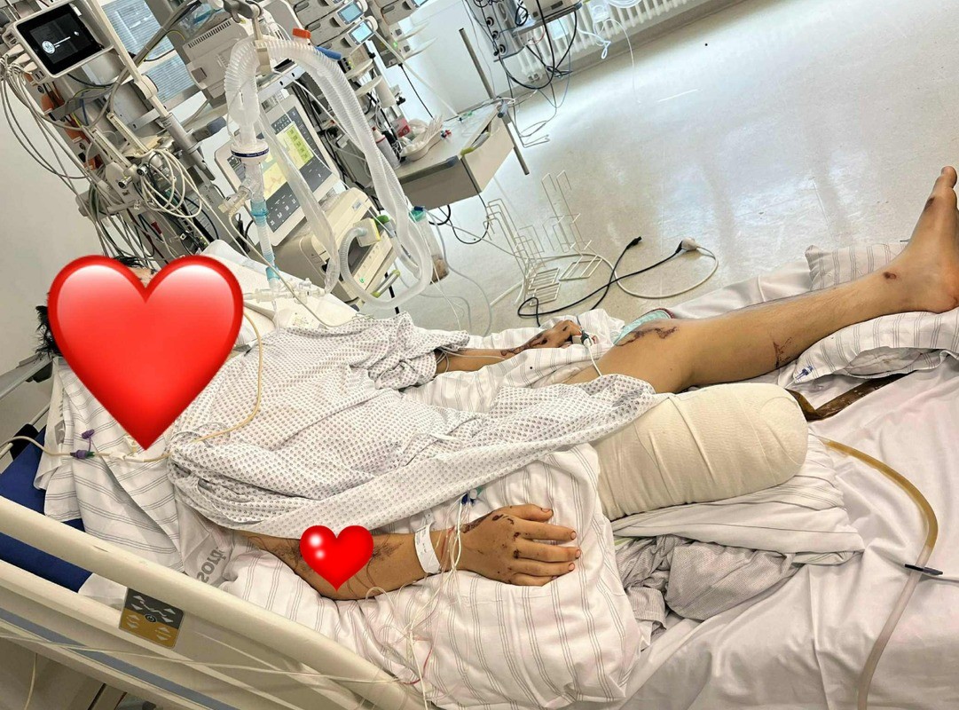 Tài xế ô tô sử dụng bóng cười đâm chết 2 du học sinh người Việt tại Đức Tài xế ô tô đâm tử vong hai du học sinh người Việt tại Đức