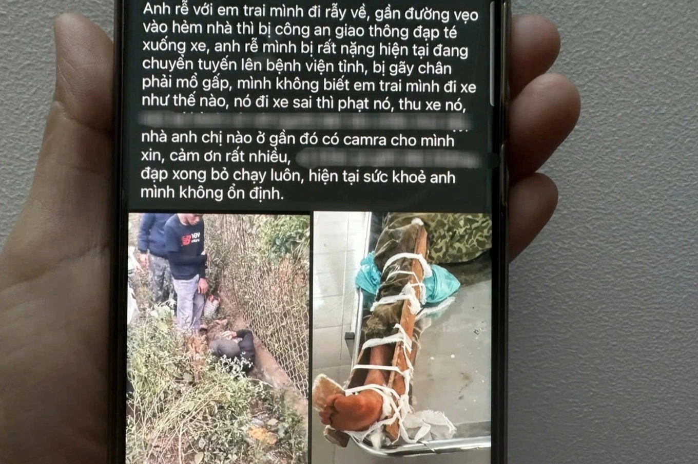 CSGT Đắk Lắk lên tiếng về vụ bị tố đạp người dân ngã xe, gãy chân CSGT Đắk Lắk lên tiếng về vụ bị tố đạp người dân ngã xe, gãy chân