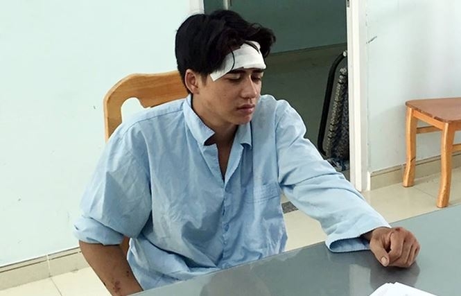 Thượng úy CSGT bị thương nghiêm trọng do kéo lê 10m thuong uy csgt bi thuong nghiem trong do keo le 10m