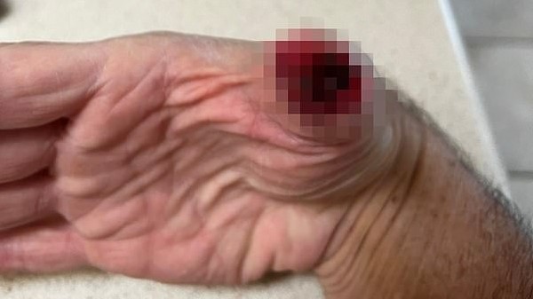 Hãng Mercedes bị kiện vì tính năng lên kính tự động làm đứt ngón tay khách hàng