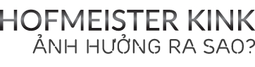 hofmeister kink tren xe bmw dieu khong phai ai cung biet