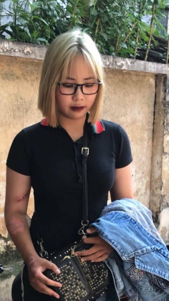 Cô gái 15 tuổi tông gục 2 cảnh sát cơ động rồi đăng status tìm người... cứu co gai 15 tuoi tong guc 2 canh sat co dong roi dang status tim nguoi cuu